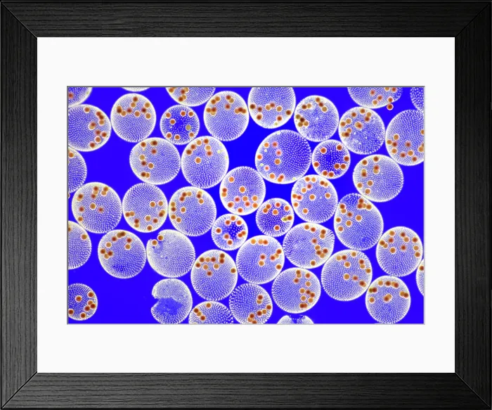 Framed Print : Volvox tertius, Zygospores Framed Print : Volvox tertius, Zygospores