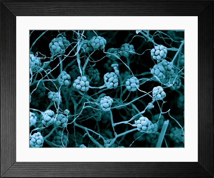 Framed Print : Stachybotrys chartarum
