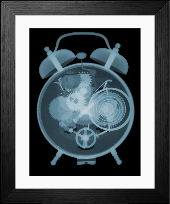 Framed Print : X-ray of an Alarm Clock Framed Print : X-ray of an Alarm Clock