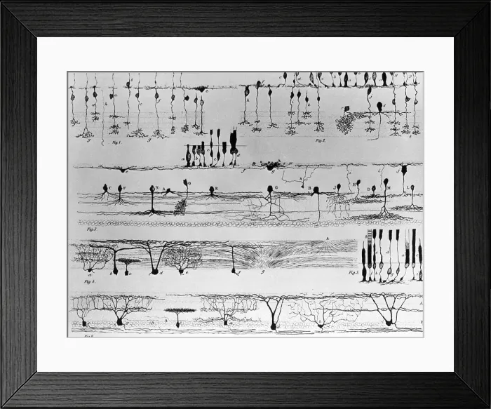 Framed Print : Nerve Structure of the Retina Framed Print : Nerve Structure of the Retina