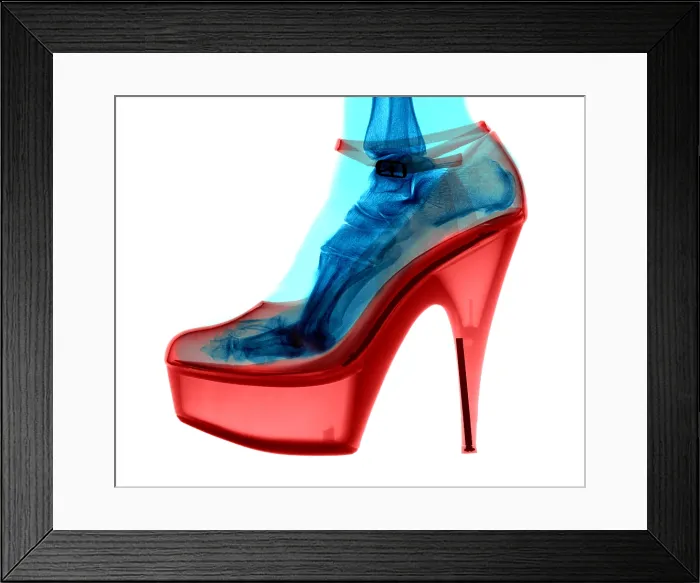 Framed Print : An X-ray of a High Heel Shoe