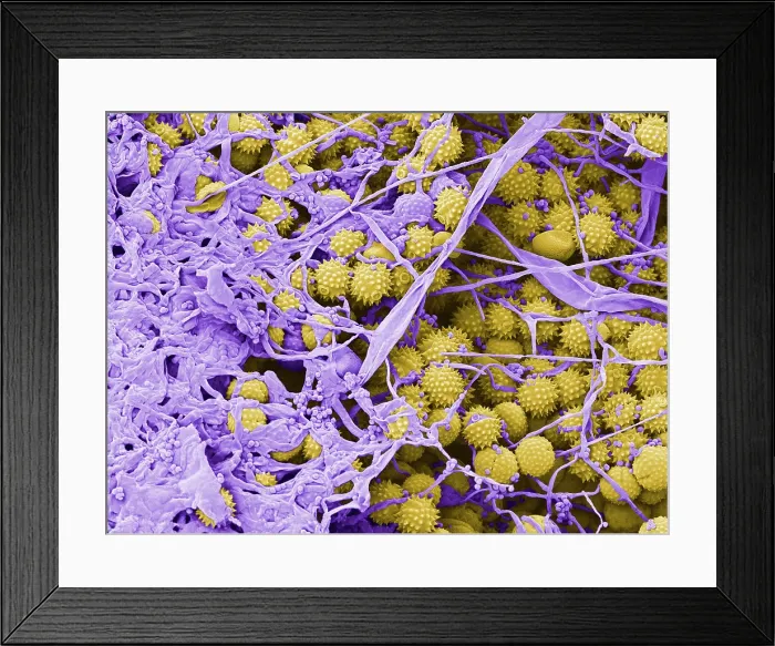 Framed Print : Pollen Grains with Fungal Growth, scanning electron micrograph Framed Print : Pollen Grains with Fungal Growth, scanning electron micrograph
