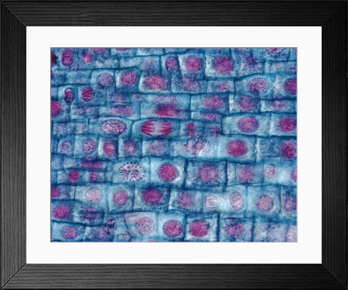 Framed Print : Onion root mitosis under a microscope