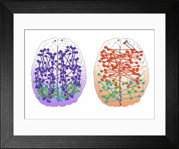 Framed Print : Male & Female Brain Connections Framed Print : Male & Female Brain Connections