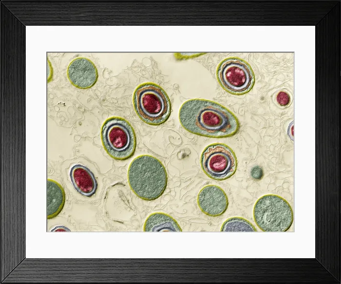 Framed Print : Anthrax bacteria, Bacillus anthracis, TEM Framed Print : Anthrax bacteria, Bacillus anthracis, TEM