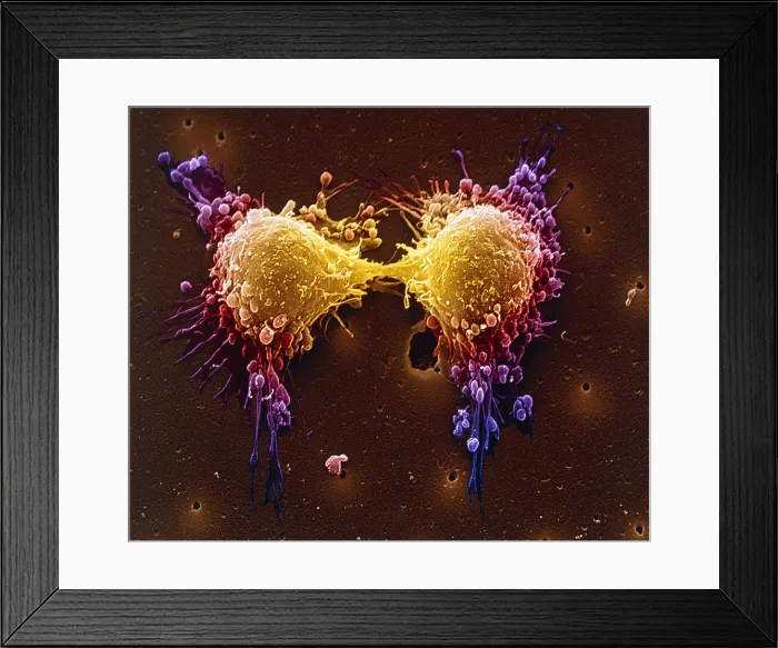 Framed Print : Cancer cell division
