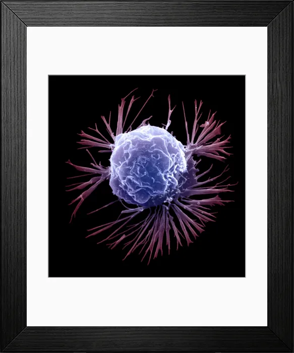 Framed Print : Breast Cancer Cell Framed Print : Breast Cancer Cell