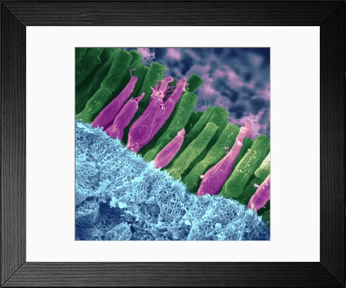 Framed Print : Rods and cones of the Eye's Retina, Under a Scanning Electron Microscope (SEM) Framed Print : Rods and cones of the Eye's Retina, Under a Scanning Electron Microscope (SEM)