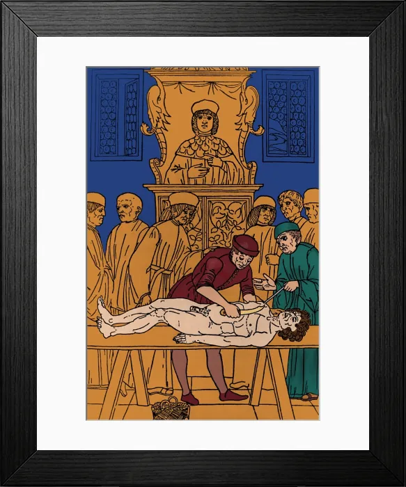 Framed Print : Dissection of Cadaver, 1491 Framed Print : Dissection of Cadaver, 1491