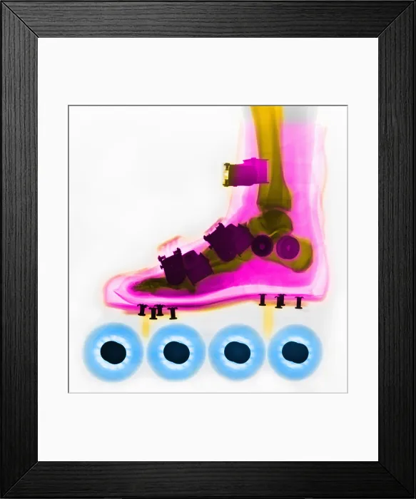 Framed Print : Rollerbade, Foot, X-Ray Framed Print : Rollerbade, Foot, X-Ray