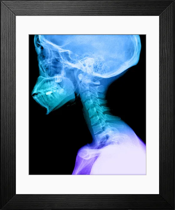 Framed Print : Human Skull and Cervical Spine Framed Print : Human Skull and Cervical Spine