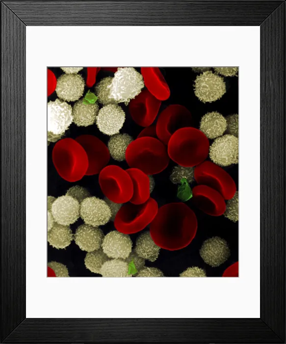 Framed Print : Blood cells Framed Print : Blood cells