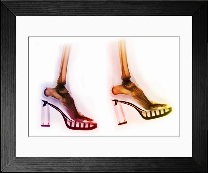 Framed Print : Feet in High-Heeled Shoes, X-Rays Framed Print : Feet in High-Heeled Shoes, X-Rays