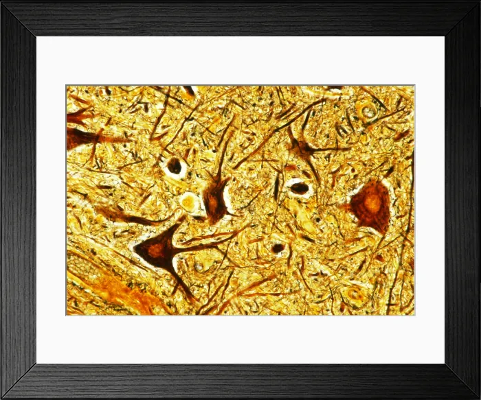 Framed Print : Human spinal cord Nerve tissue under a microscope Framed Print : Human spinal cord Nerve tissue under a microscope