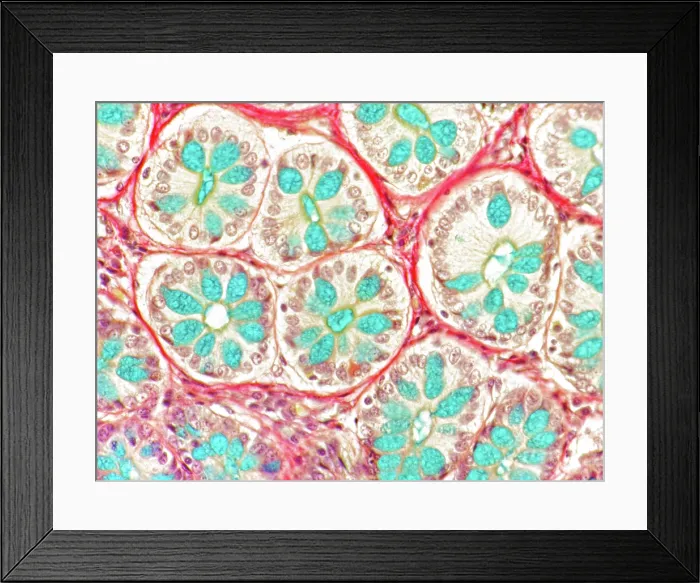 Framed Print : Mucus glands, rectum, light micrograph