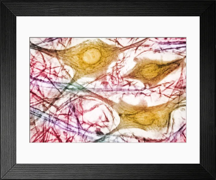 Framed Print : Spinal Cord Motor Cells, light micrograph