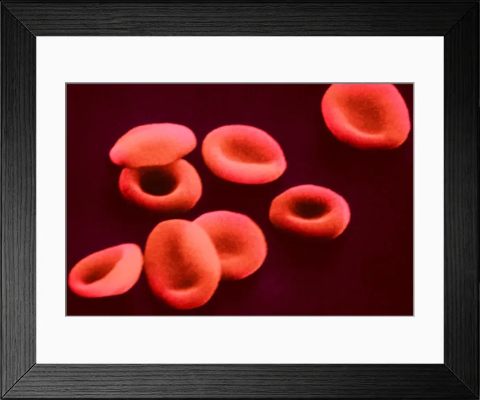 Framed Print : Red Blood Cells, under a microscope (SEM) Framed Print : Red Blood Cells, under a microscope (SEM)