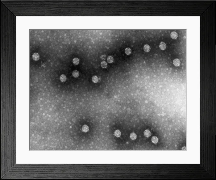 Framed Print : Polyoma Virus Framed Print : Polyoma Virus