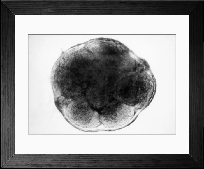 Framed Print : Human Reproduction, Ovum, 8-Cell Stage, light micrograph Framed Print : Human Reproduction, Ovum, 8-Cell Stage, light micrograph