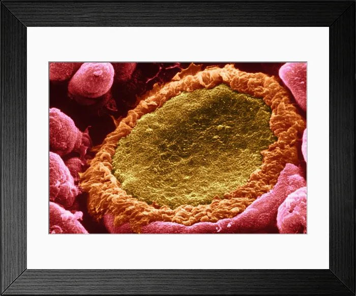 Framed Print : Taste bud. Color enhanced electron micrograph of taste buds; groups of Framed Print : Taste bud. Color enhanced electron micrograph of taste buds; groups of