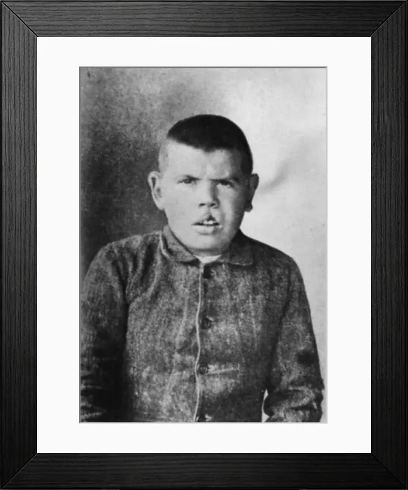 Framed Print : Patient of Cesare Lombroso