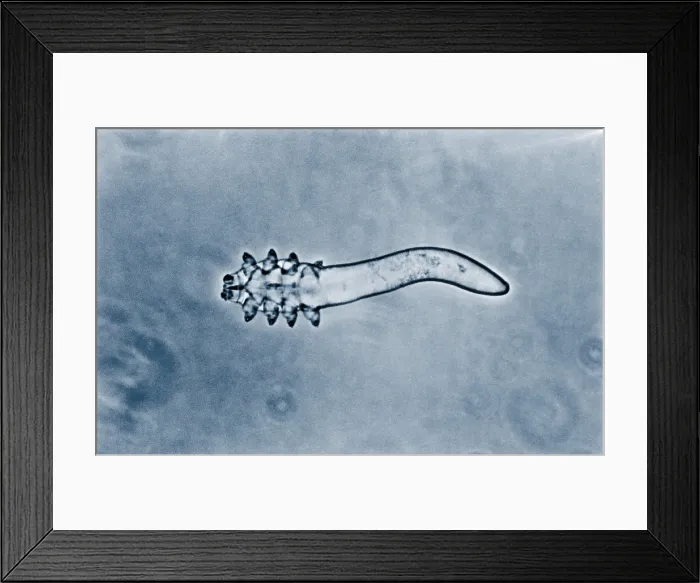 Framed Print : Hair follicle mite Framed Print : Hair follicle mite