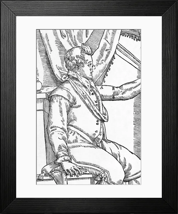 Framed Print : One of Tagliacozzi's Rhinoplasty Methods, 1 of 6