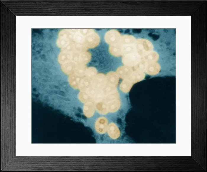 Framed Print : MeV, Measles Virus, TEM Framed Print : MeV, Measles Virus, TEM