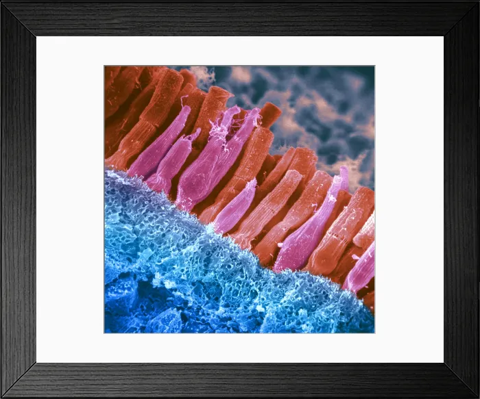 Framed Print : Rods and cones of the Eye's Retina, Under a Scanning Electron Microscope (SEM)