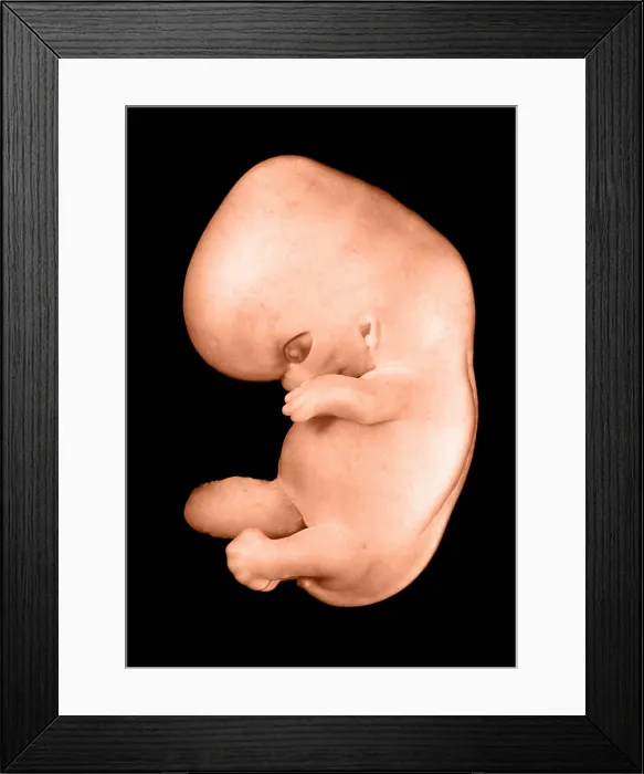 Framed Print : 44 day old human embryo Framed Print : 44 day old human embryo