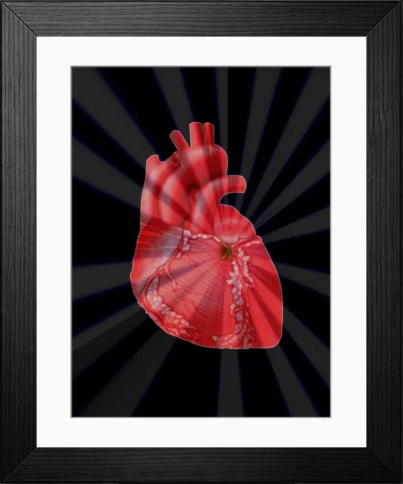 Framed Print : Heart Attack, Conceptual Illustration
