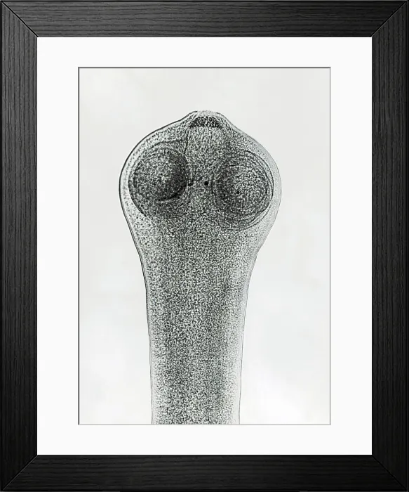 Framed Print : Scolex of a Tapeworm (Dipylidium sp.) under a microscope Framed Print : Scolex of a Tapeworm (Dipylidium sp.) under a microscope