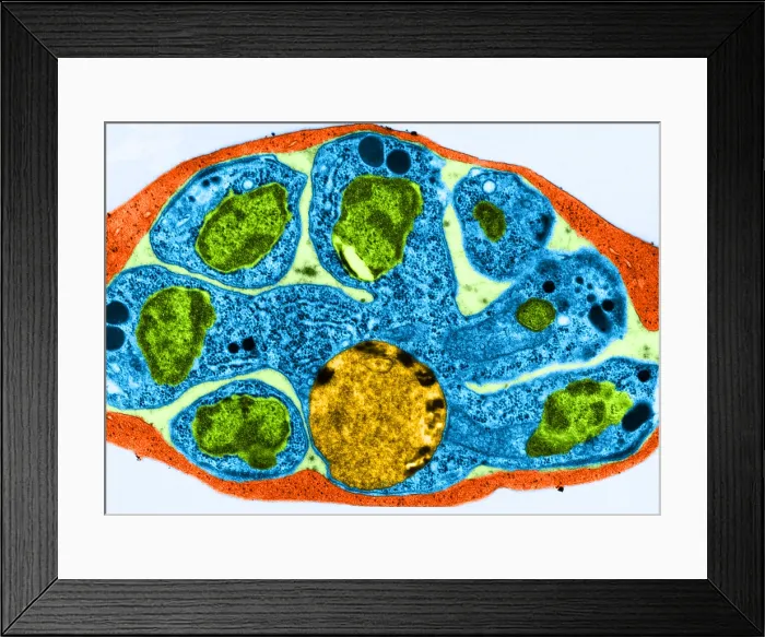 Framed Print : Malaria, Plasmodium cathemerium, TEM Framed Print : Malaria, Plasmodium cathemerium, TEM