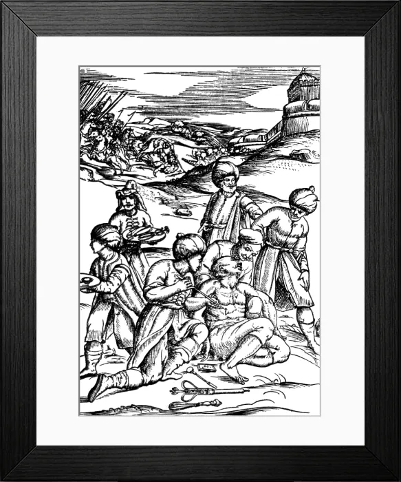 Framed Print : Battlefield Medicine, 16th Century Framed Print : Battlefield Medicine, 16th Century