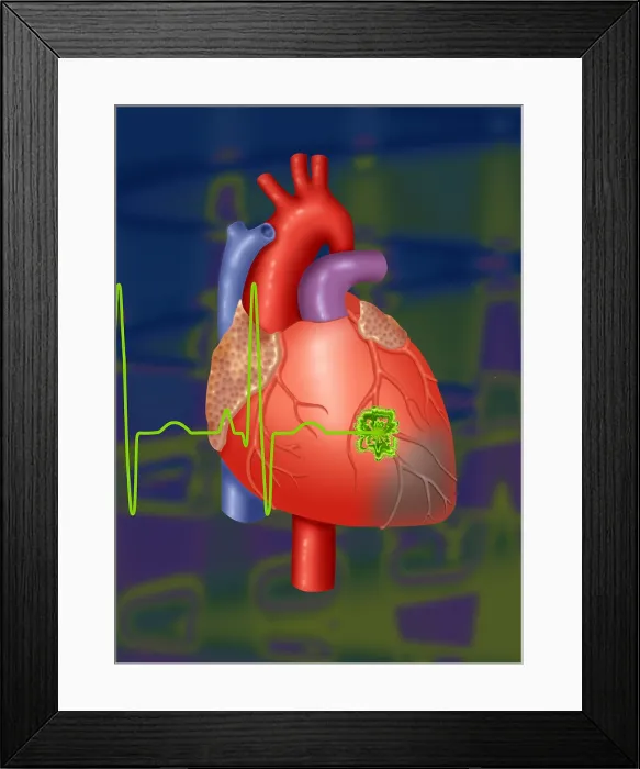 Framed Print : Heart Attack Framed Print : Heart Attack