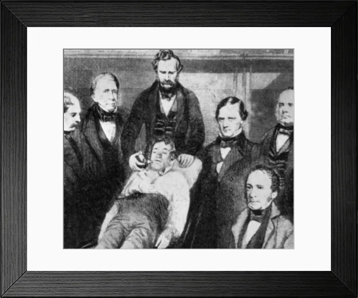 Framed Print : First Use of Surgical Anesthesia, 1846