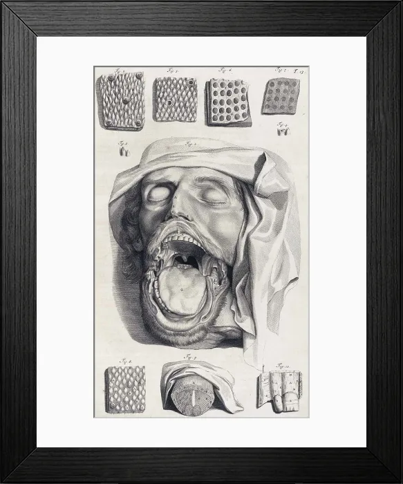 Framed Print : Anatomia humani corporis, Table 13, 1690 Framed Print : Anatomia humani corporis, Table 13, 1690