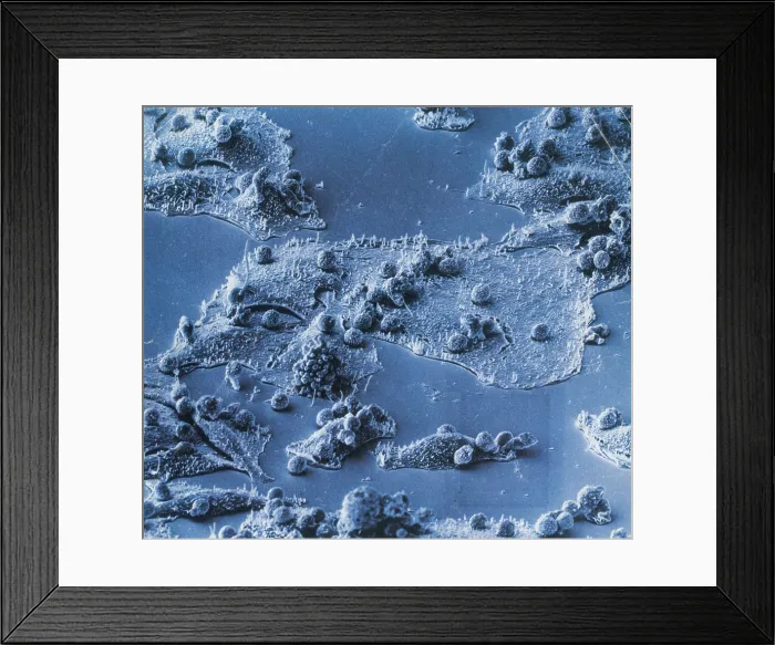 Framed Print : Immune Cells Attacking Cancer Cells, under a microscope (SEM) Framed Print : Immune Cells Attacking Cancer Cells, under a microscope (SEM)
