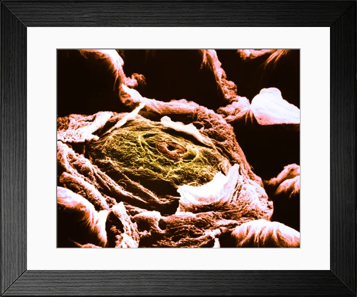 Framed Print : Human tongue papilla, under a microscope (SEM) Framed Print : Human tongue papilla, under a microscope (SEM)