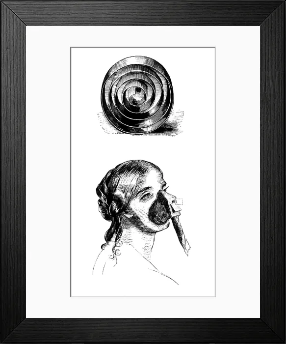Framed Print : John Snow, Ether Inhaler, 1847 Framed Print : John Snow, Ether Inhaler, 1847