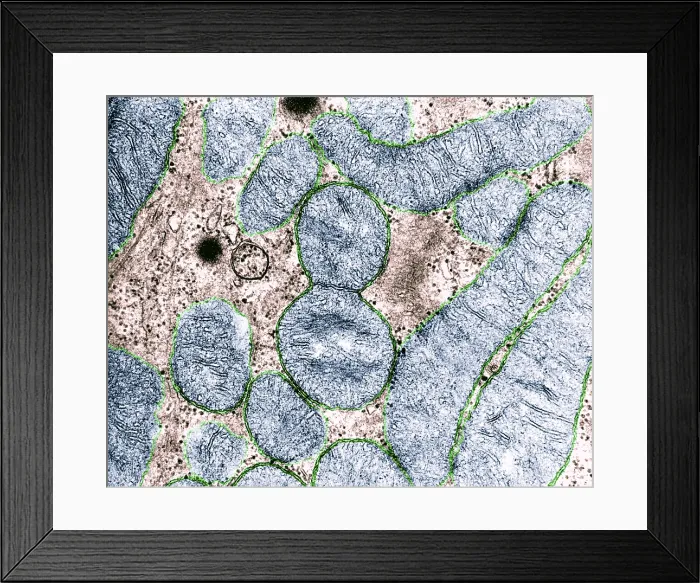 Framed Print : Dividing Mitochondrion, TEM Framed Print : Dividing Mitochondrion, TEM