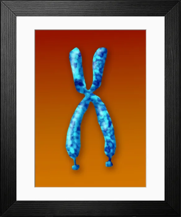 Framed Print : Fragile X Syndrome (FXS) is a genetic condition often associated with autism spectrum disorder (ASD), illustration Framed Print : Fragile X Syndrome (FXS) is a genetic condition often associated with autism spectrum disorder (ASD), illustration