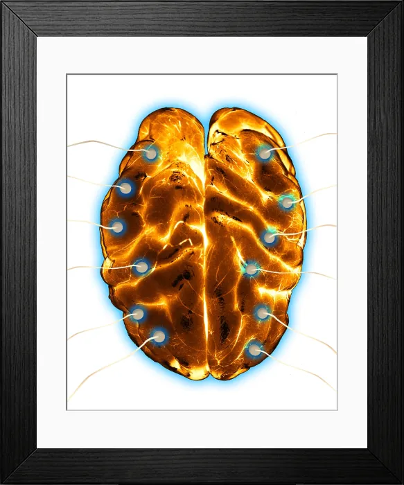 Framed Print : Brain EEG. Illustration of a brain undergoing an EEG (electroencephalogram) Framed Print : Brain EEG. Illustration of a brain undergoing an EEG (electroencephalogram)