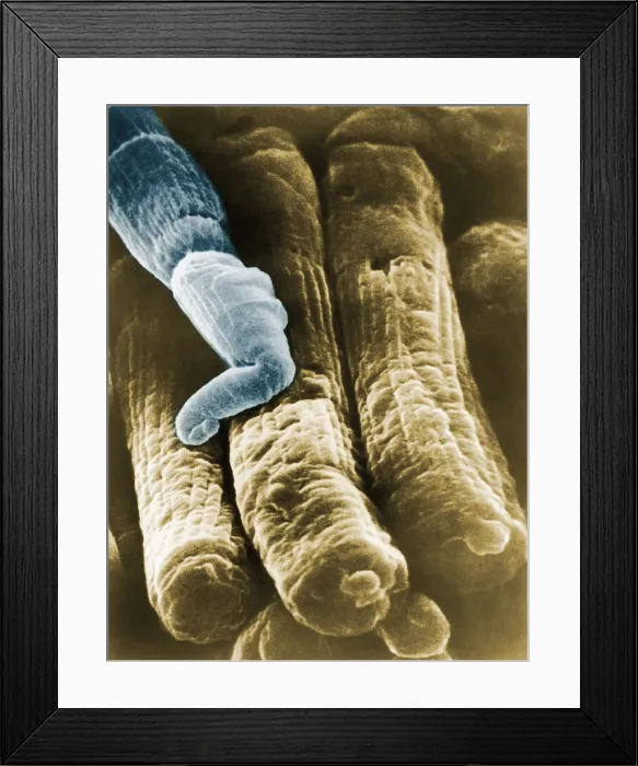 Framed Print : Rods and Cones