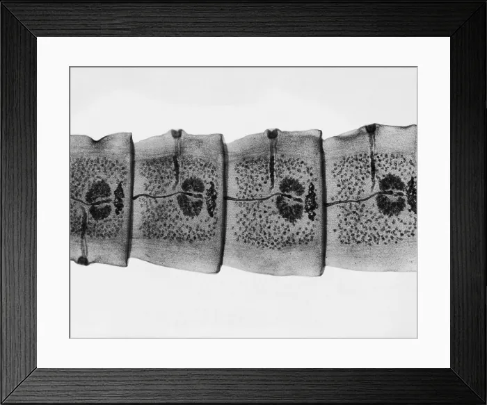 Framed Print : Dog Tapeworm under a microscope Framed Print : Dog Tapeworm under a microscope