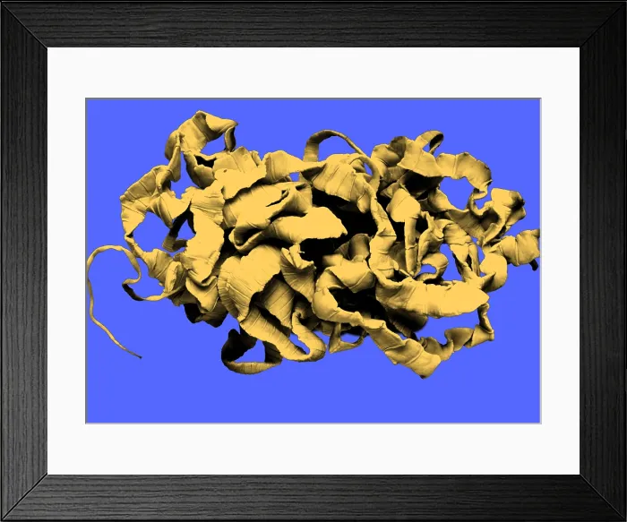 Framed Print : Human Tapeworm, gross specimen Framed Print : Human Tapeworm, gross specimen