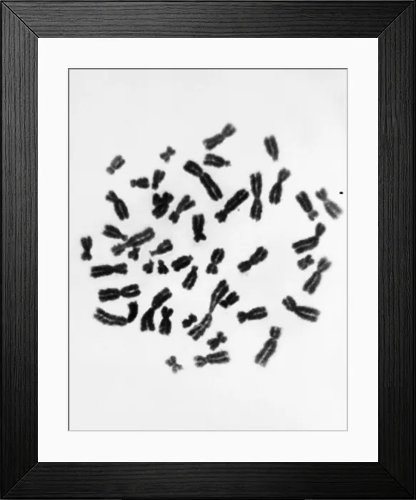 Framed Print : Karyotype, Normal Female Chromosomes Framed Print : Karyotype, Normal Female Chromosomes