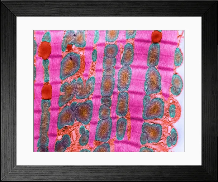 Framed Print : Cardiac Muscle, TEM Framed Print : Cardiac Muscle, TEM