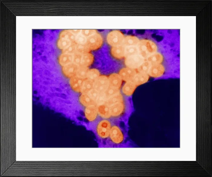 Framed Print : MeV, Measles Virus, TEM