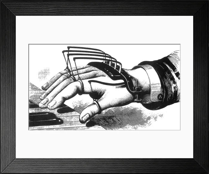 Framed Print : Atkins Finger-Supporting Device, 1881 Framed Print : Atkins Finger-Supporting Device, 1881